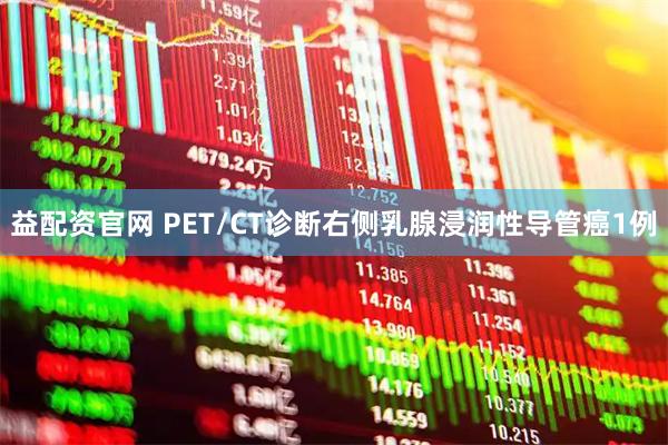益配资官网 PET/CT诊断右侧乳腺浸润性导管癌1例